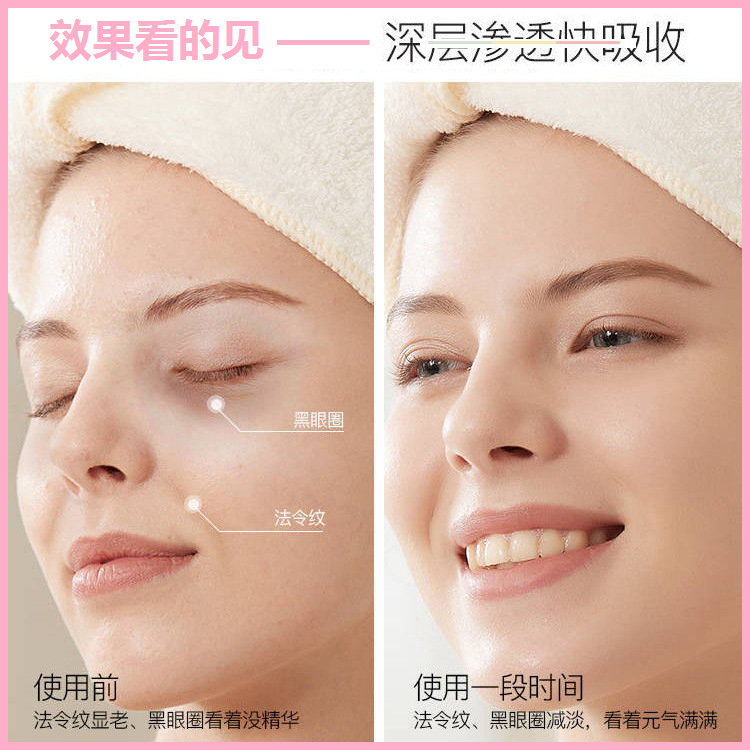 網紅微晶法令紋膜貼淡化細紋淡皺魔貼保濕補水收緊v臉提拉臉貼女OEM代加工