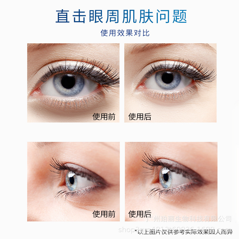 眼部套盒美容院專用凈化眼球spa霧化提拉緊致護理眼霜淡化黑眼圈OEM代加工