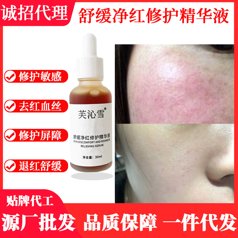 去紅血絲修護精華液修復面部激素臉敏感肌OEM代工廠